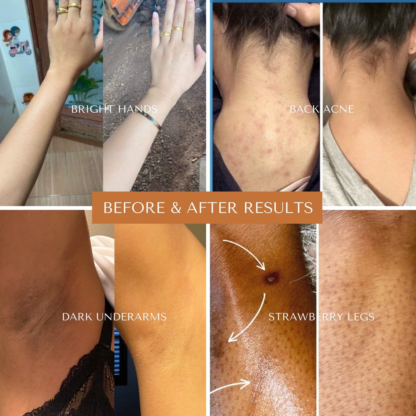 Turmeric & kojic Glow Scrub – Brightens + Exfoliates