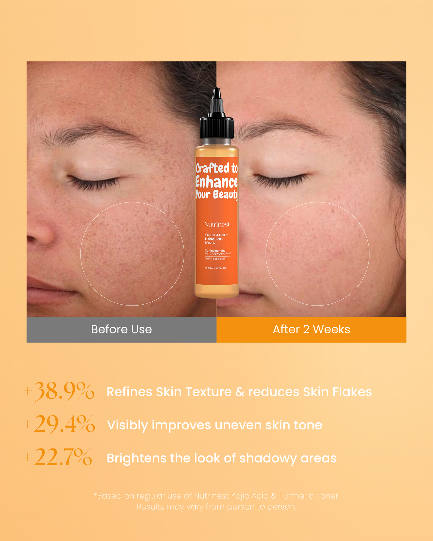 Turmeric & kojic acid Toner
