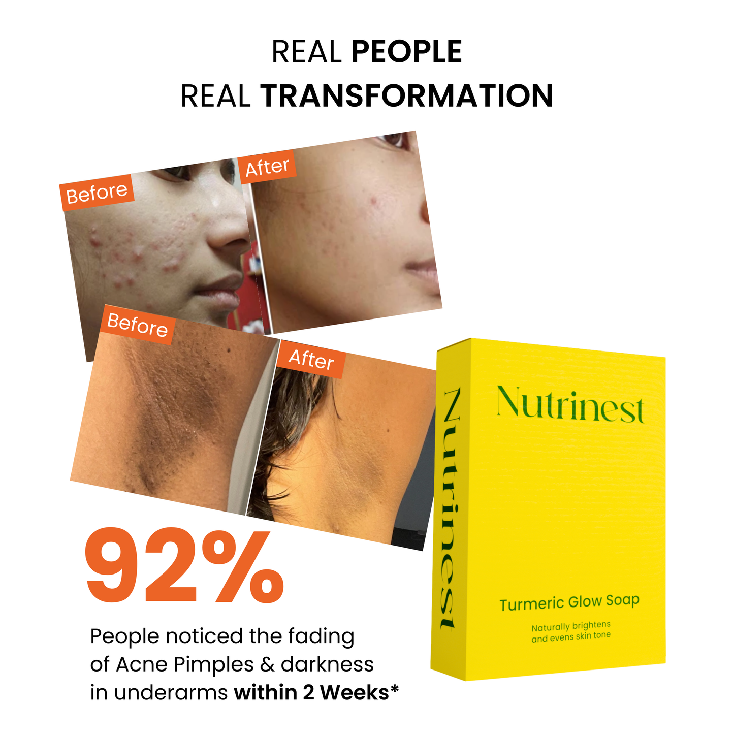 Turmeric & kojic acid brightening soap