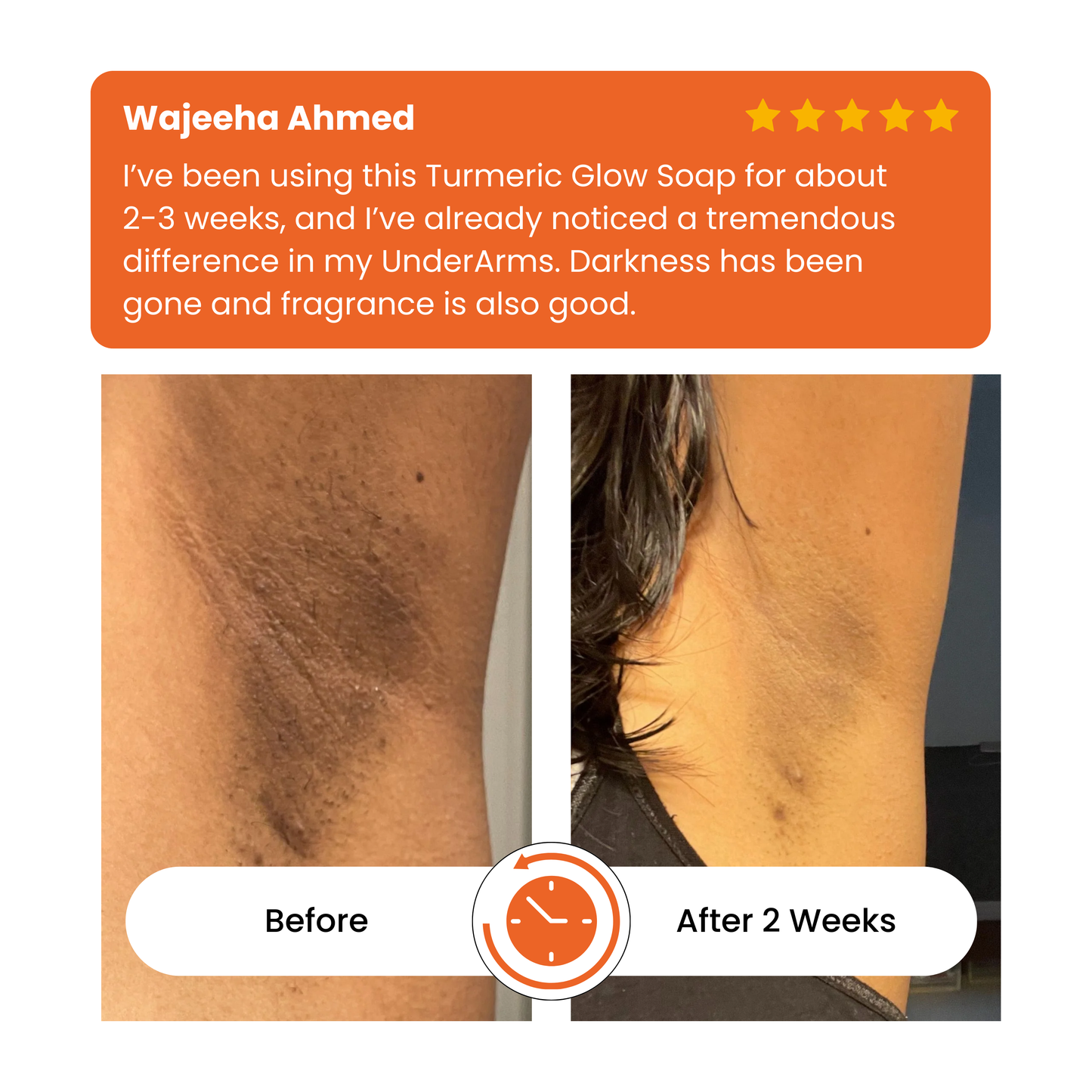 Turmeric & kojic acid brightening soap