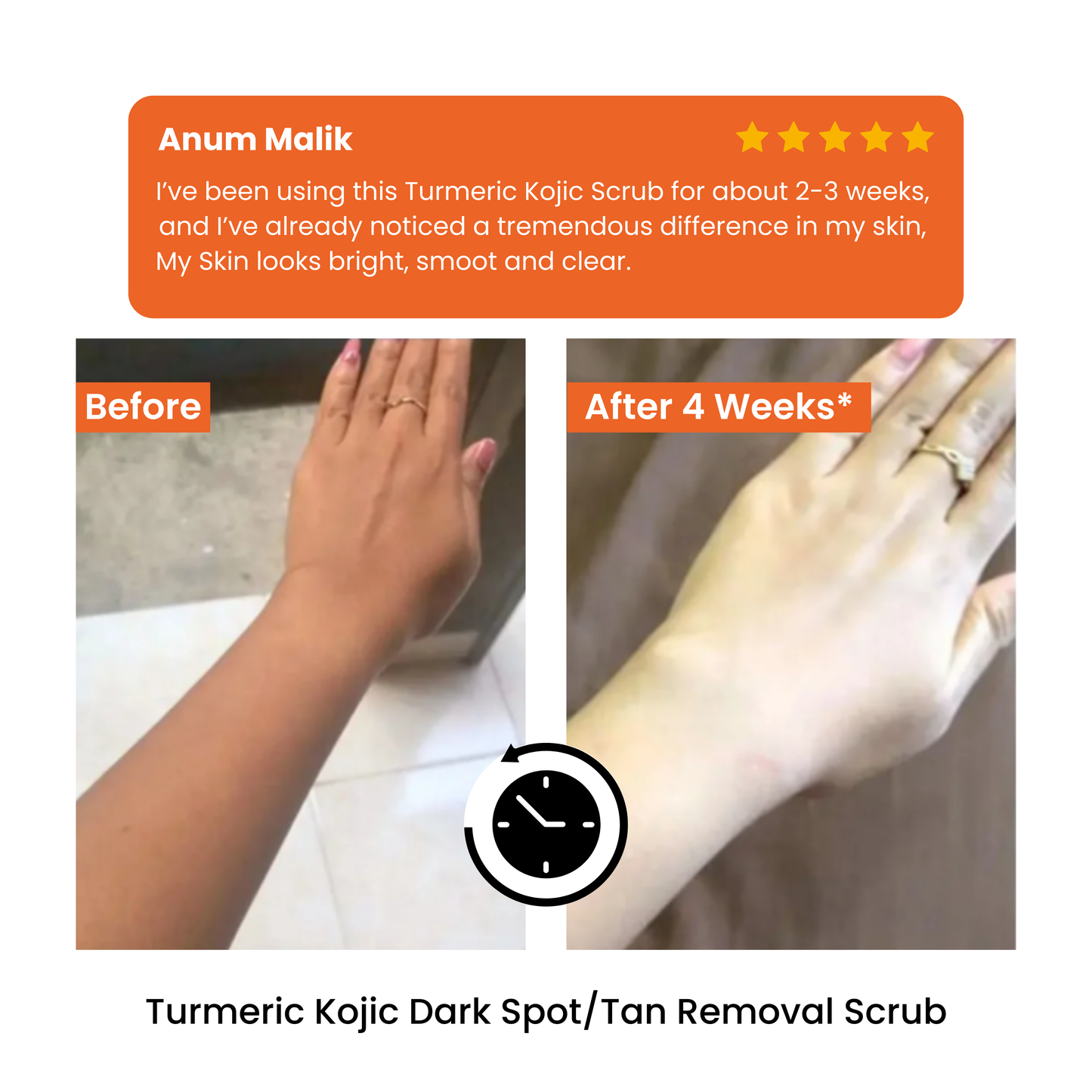 Turmeric & kojic Glow Scrub – Brightens + Exfoliates